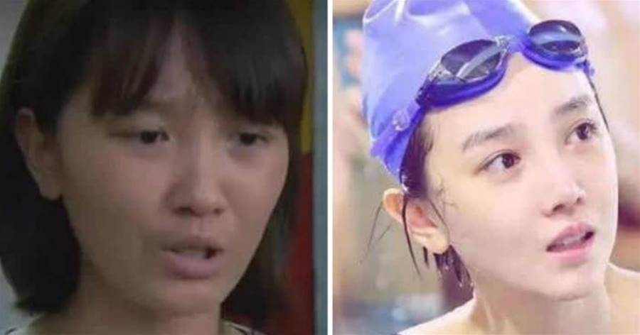 歪瓜裂棗整成絕美女神，這5位女星靠變臉逆襲，如今全都大紅大紫